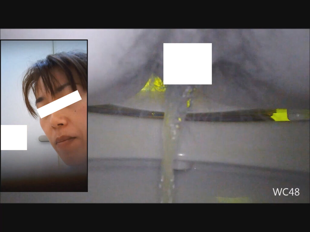 洋式トイレ便器内＆顔アップの2カメ盗撮② | 盗撮動画 | Ansuko.net